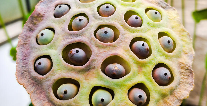 weird-skin-diseases-with-holes