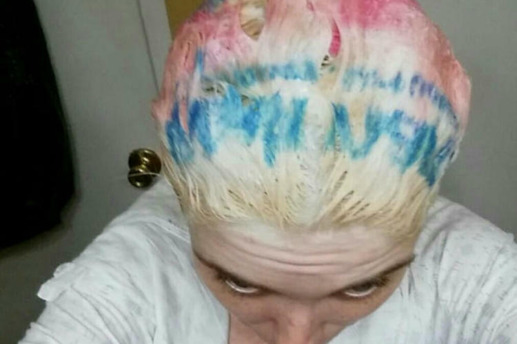 29 Total Idiots Who Tried To Dye Their Own Hair And Failed